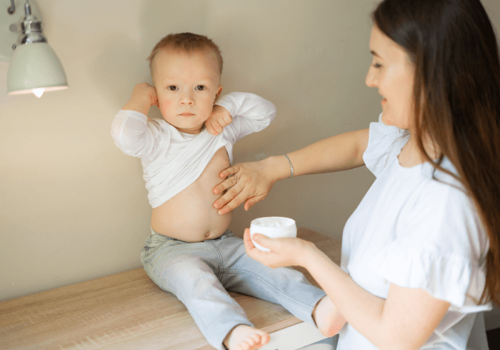 dermatita atopica poze