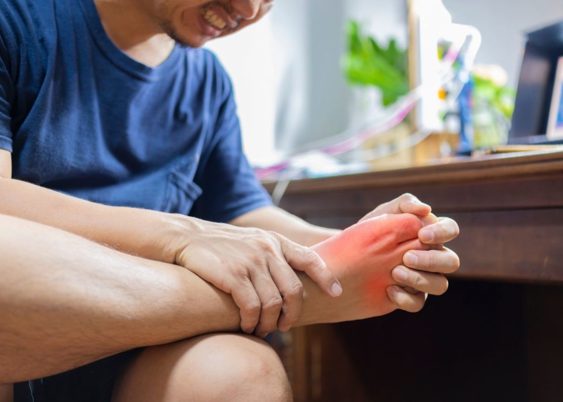 Guta si stilul de viata – cum sa reduci inflamatia articulatiilor