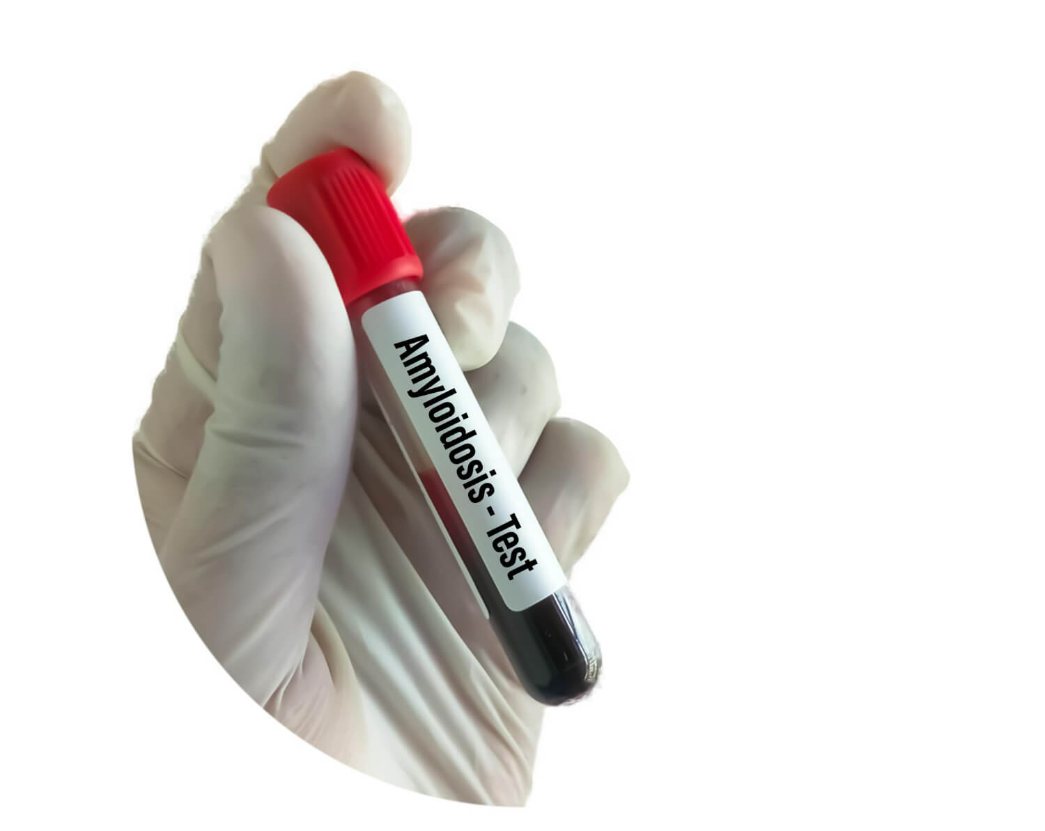 rolul proteinelor amiloide in organism