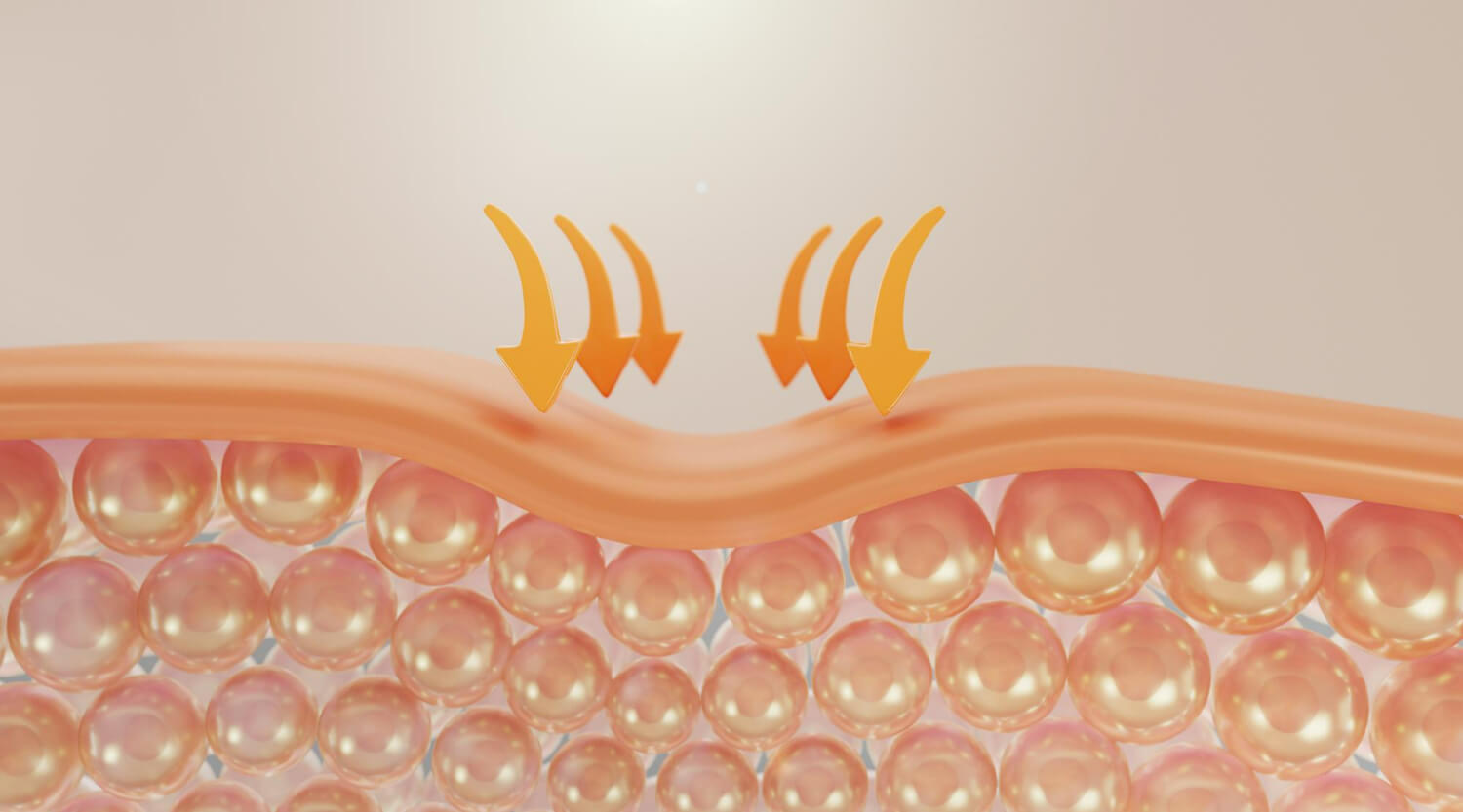 ce este colagenul verisol ce este colagenul verisol