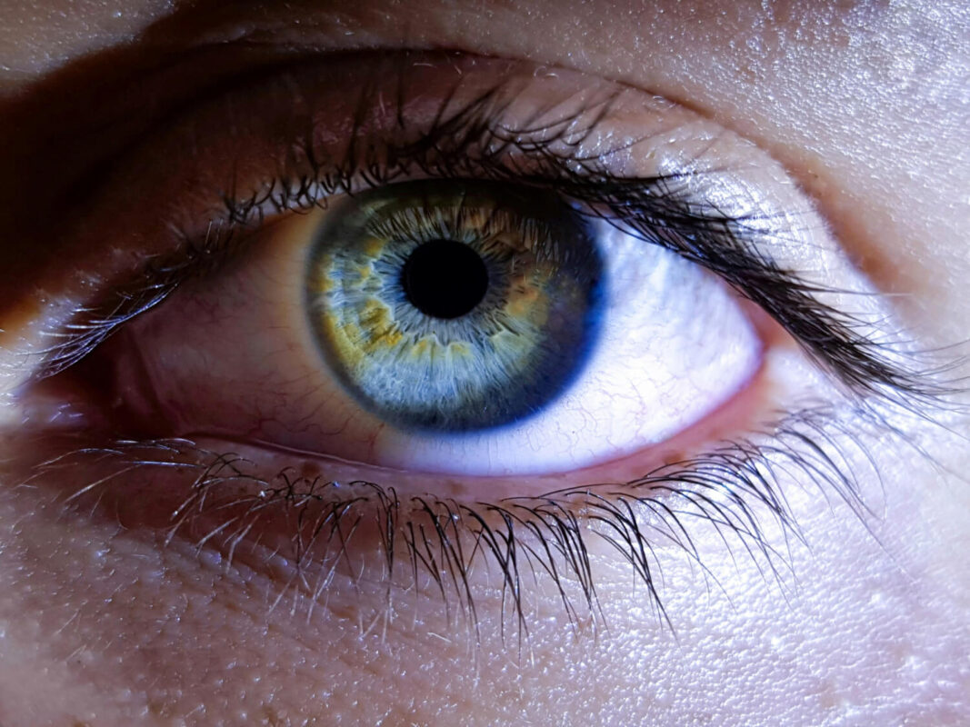 irisul ochiului