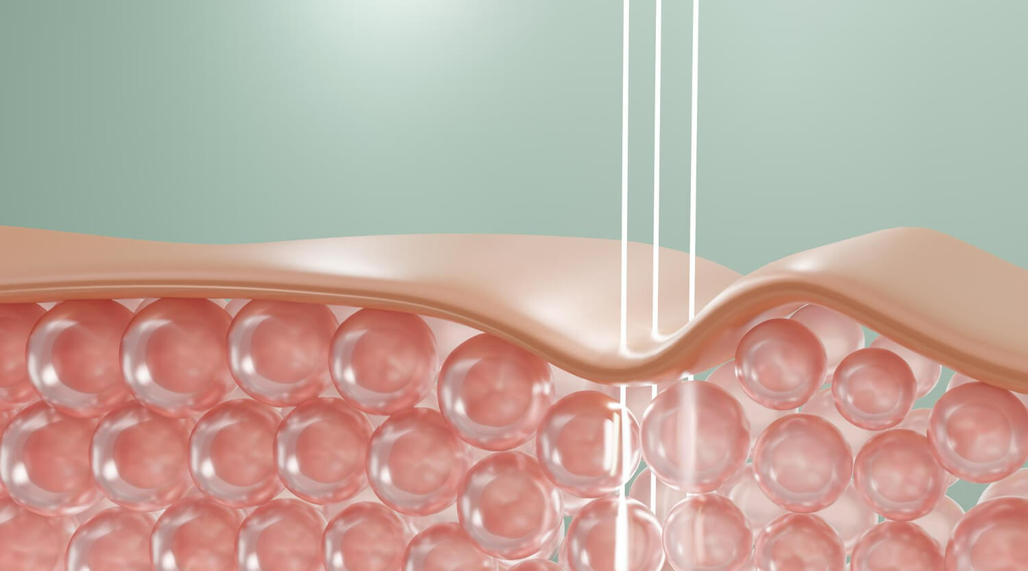 ce este elastina ce este elastina